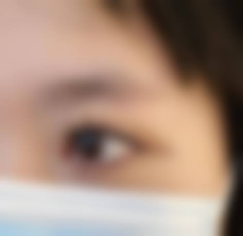 十、于诗民医生擅长项目科普:发际线种植