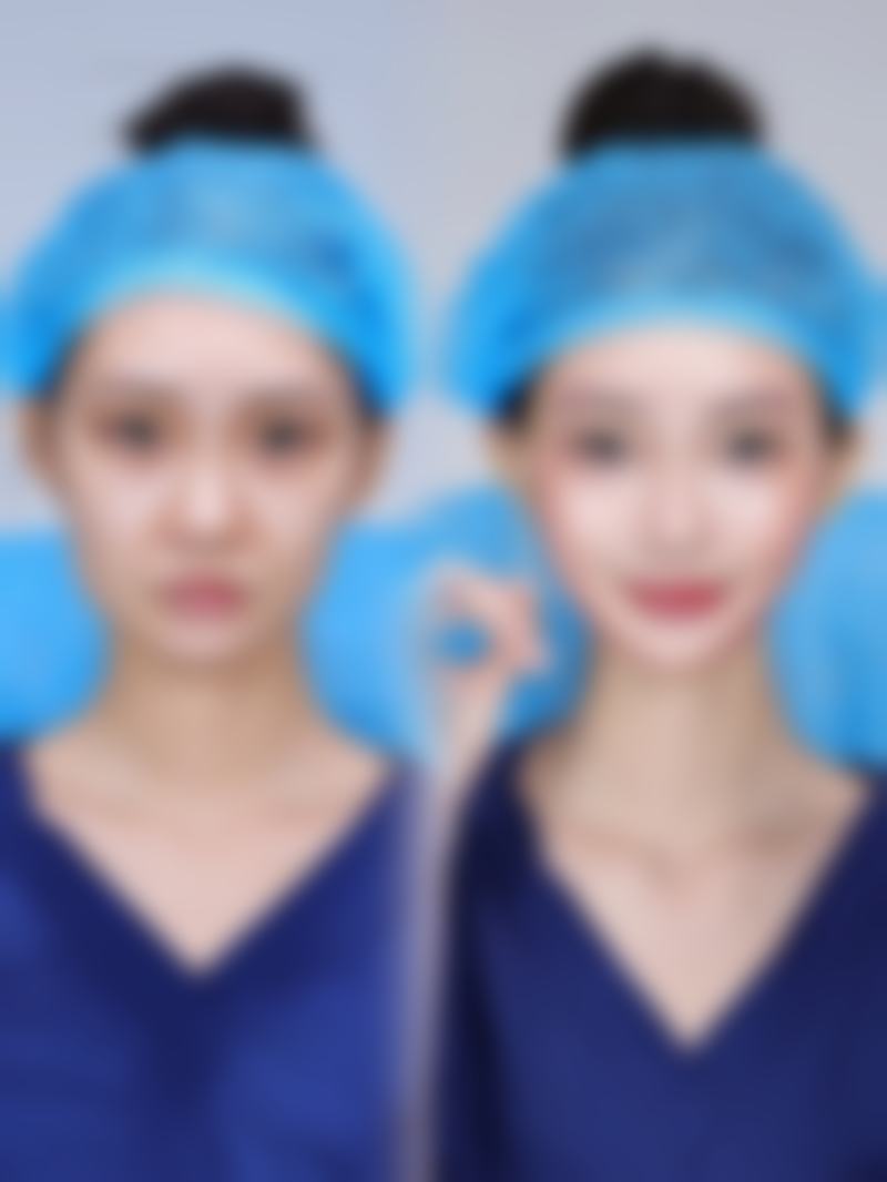 厦门长庚医院整形美容科擅长项目