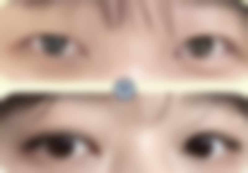 三、朱建生医生擅长项目与适合人群