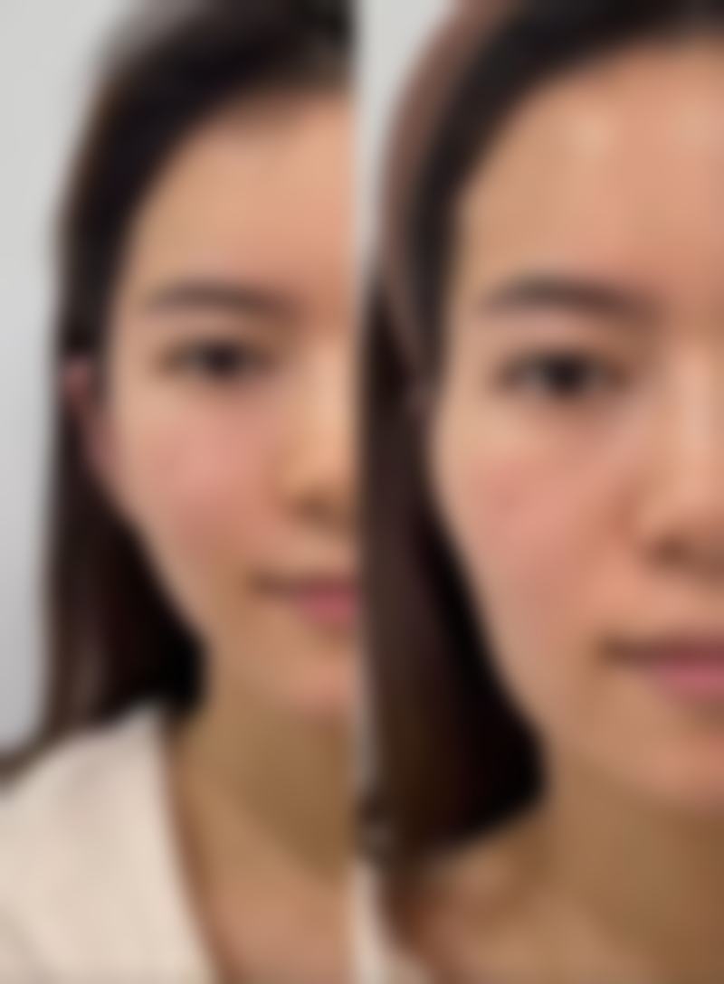 王永春医生的技术优势