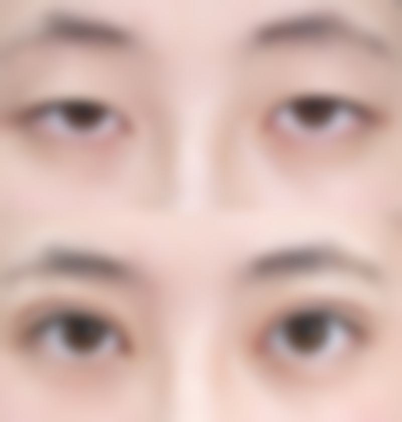 韓國可來熙Classy整形外科醫院怎麼預約掛號 術前術後避坑指南!港澳姊妹注意呢5點