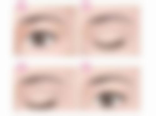 二、6D双眼皮的原理