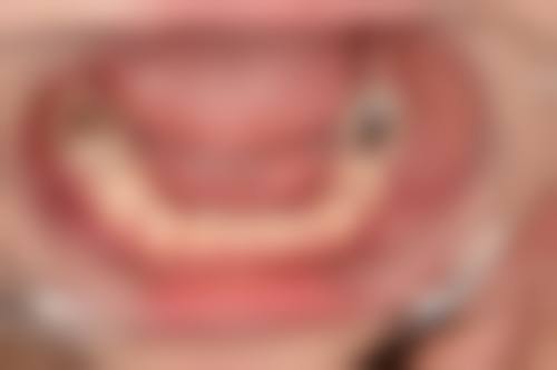 宣城德林口腔治疗反馈与口碑评价