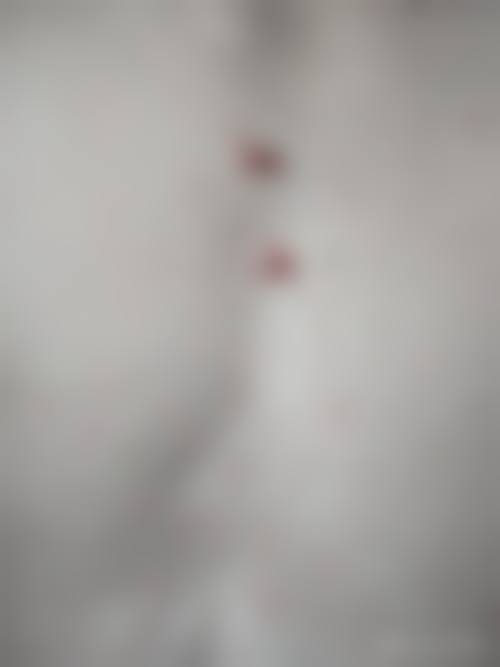 五、盘锦馥安整形医院真实实例参考