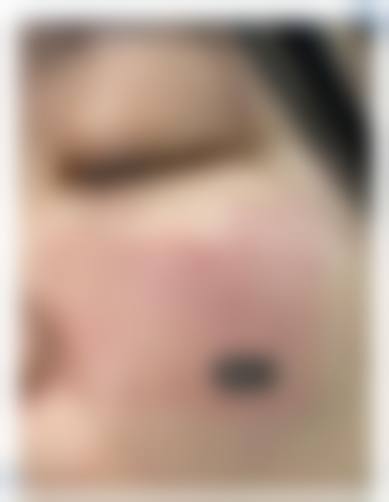 合肥立新医学美容门诊部预约挂号方式。