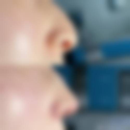 深圳皇佳医疗美容医院医生团队经验稳定。