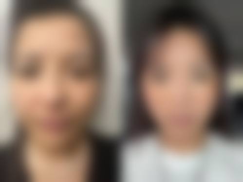 焦作金华整形医院治疗反馈与口碑评价