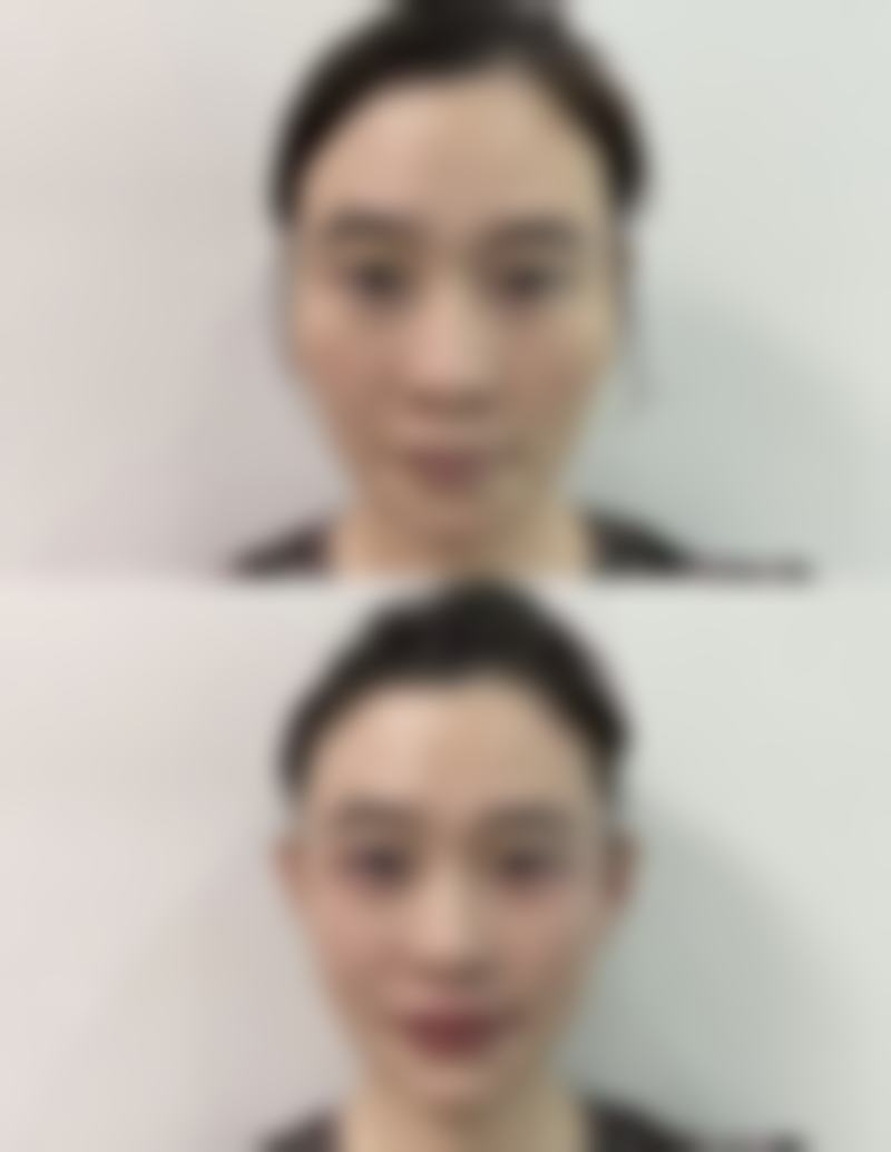 任勇医生的技术实力
