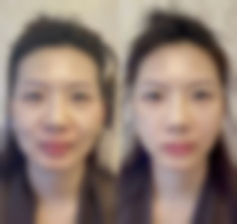 东莞百佳医疗整形医院擅长项目