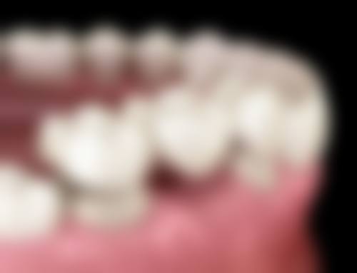 拓展延伸：港澳姊妹做口腔治療，深圳VS本地點樣揀？