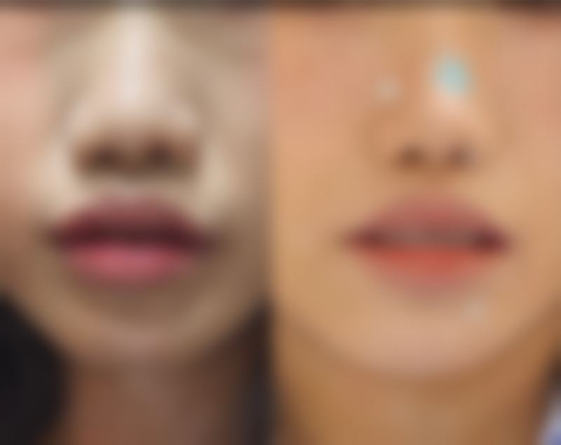 张晓萍医生的擅长项目