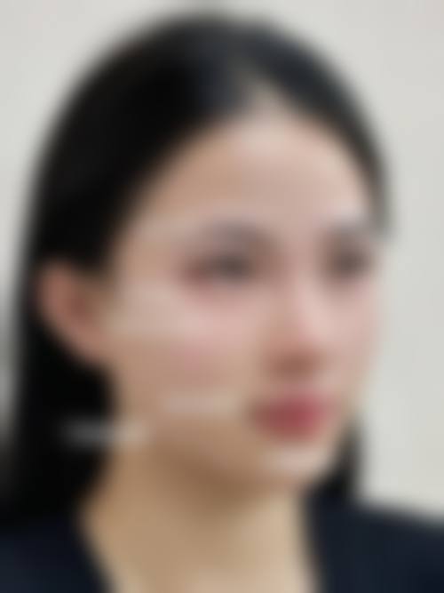 韩国B.A.E整形外科口碑评价