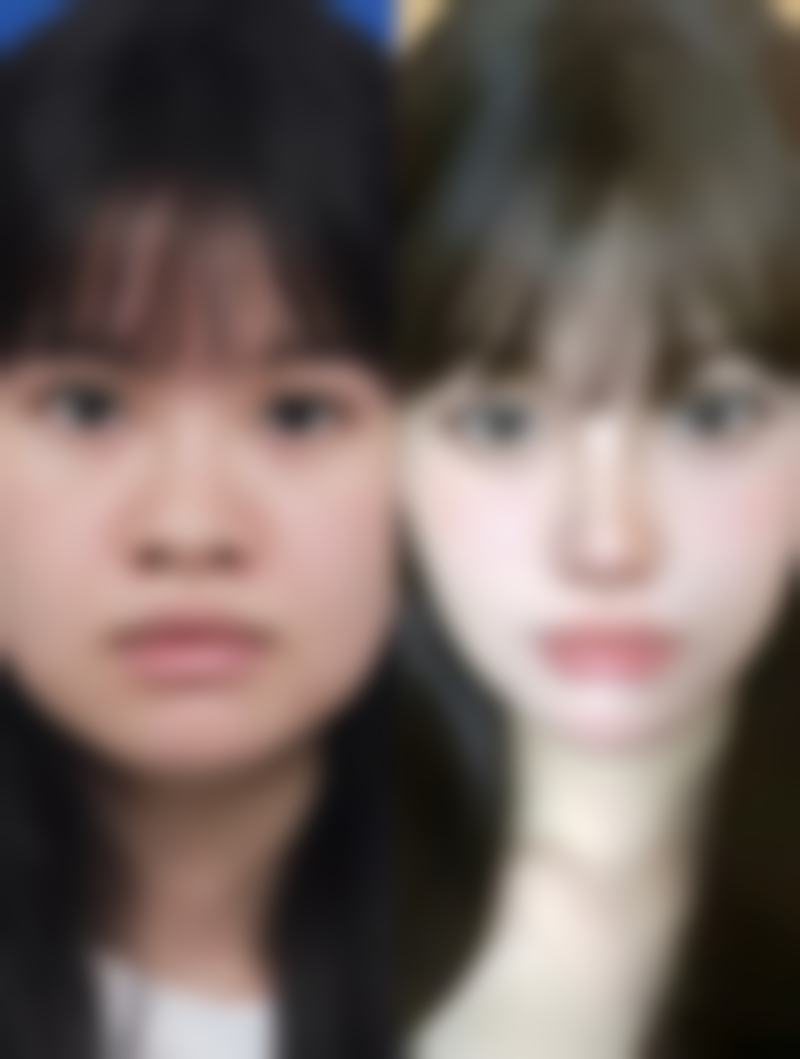 十三、韩国Dodream整形外科预约挂号
