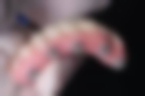 珠海牙科假牙推薦 醫生揀選要點