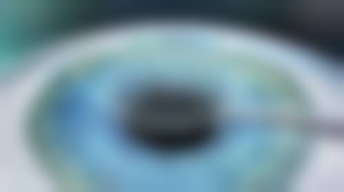 二、眼睛植入人工晶体手术需要多少钱——不同类型人工晶体价格