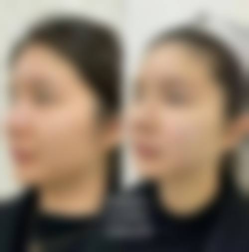 蔡黔医生技术实力体现