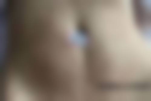 1、主要做的三大诊疗项目