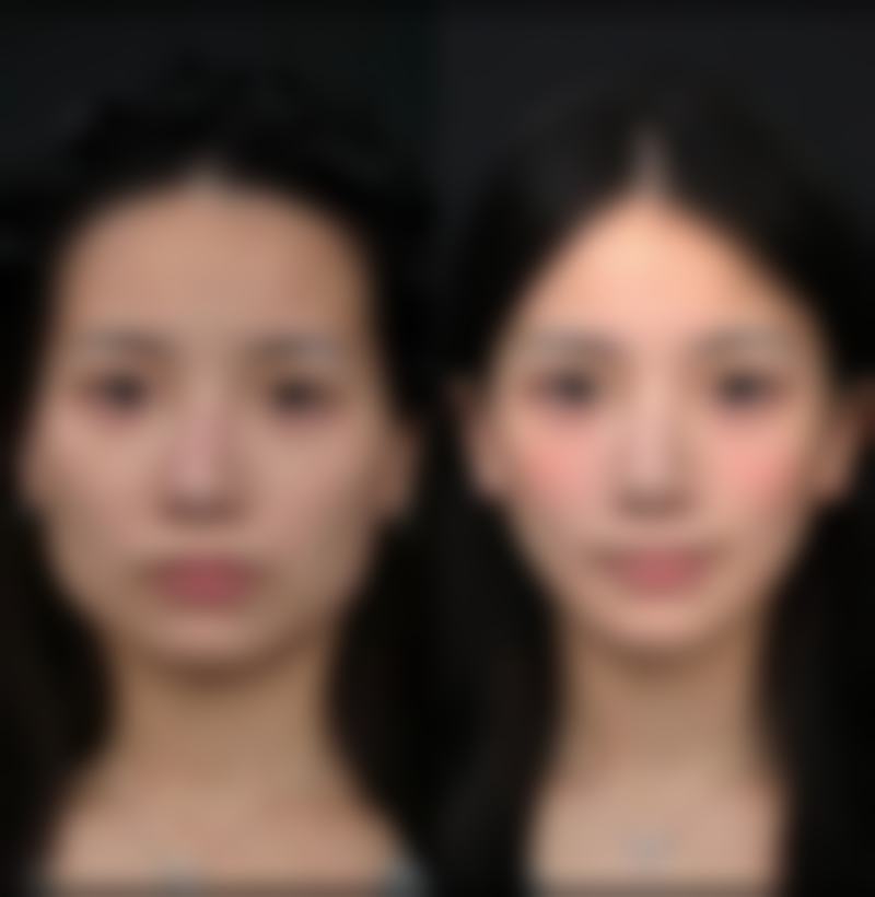 邢依萌擅长的治疗项目