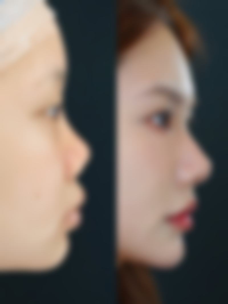 九、韩国Factps整形外科口碑与评价