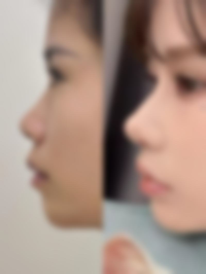 一、韩国Factps整形外科怎么样?是整形领域特色专科医院