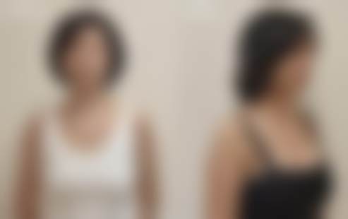 十、广州华美医疗美容整形医院真人口碑实例评价一览