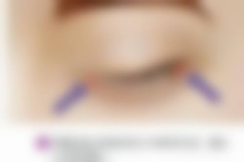 昆明薇莎整形医疗美容医院的口碑评价