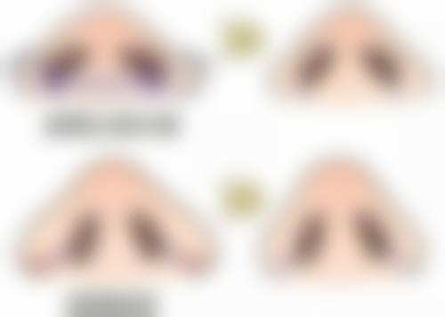 韓國reyou皮膚科怎麼預約掛號？2026預約：BeautsGO 3招免韓文秒約