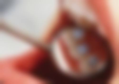 深圳牙科黑店名单2026最新曝光20间！边间上榜？查询方法+避坑指南必睇