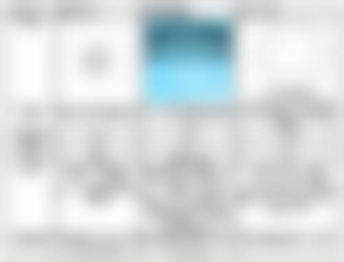 二、上海九院飞秒与晶体植入手术对比