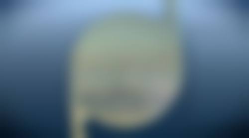 乌鲁木齐悉法诺尔眼科医院2026年价格收费表：