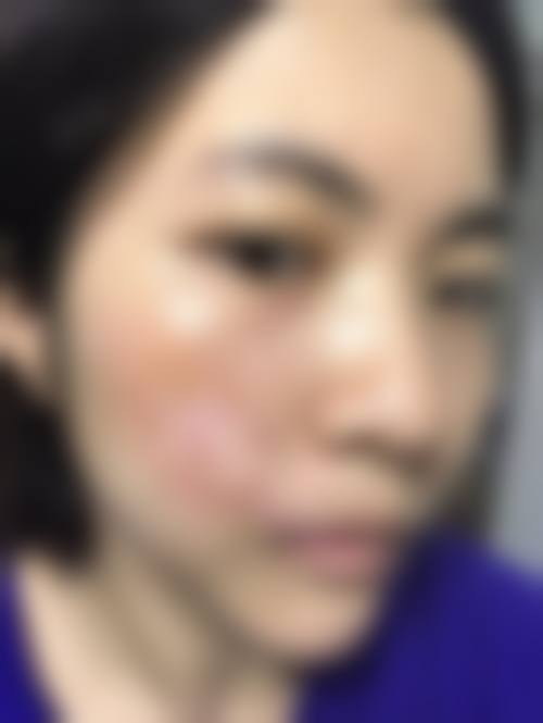 四、胡倩婷医生做手术价格: