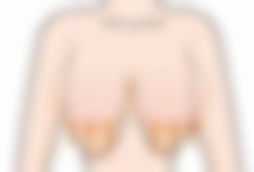 盘锦馥安整形医院擅长项目