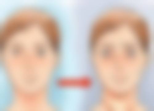 柳州市妇幼保健院眼科温馨提示