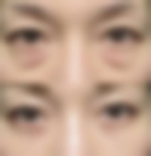 成都九州华昀惠芝美韵整形医院治疗反馈与口碑评价。