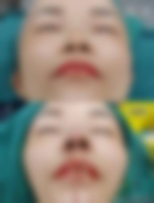 临床实例分享