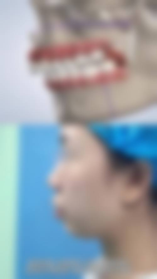 陈国鼎医生手术成效