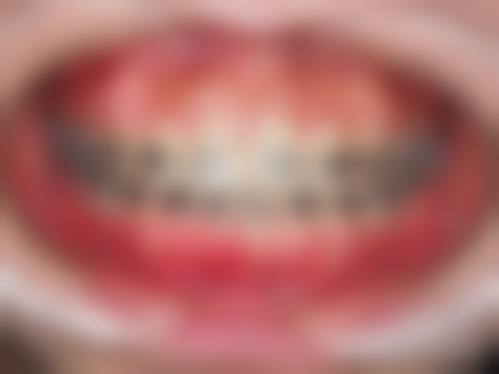 沈阳沈河嘉里大象口腔门诊部擅长项目。