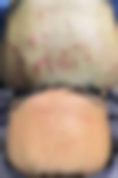 七、患者常见问题解答(精选 )