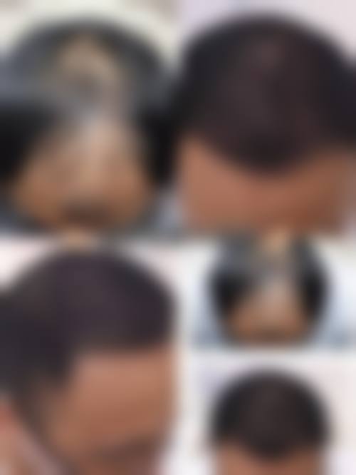 济南伊美尔整容医疗机构患者反馈如何