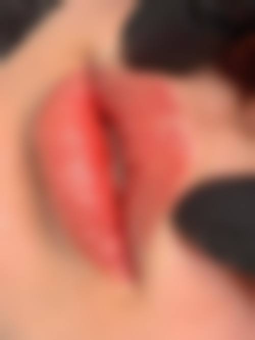 东莞艾莱美整形医疗美容门诊部擅长项目。