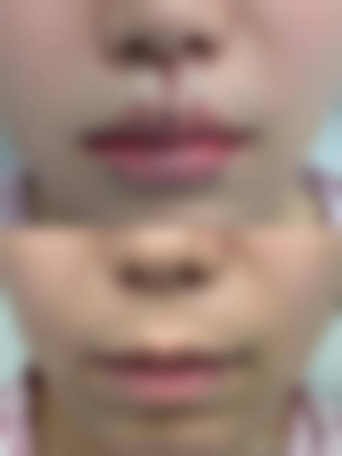 东莞艾莱美整形医疗美容门诊部预约挂号方式。