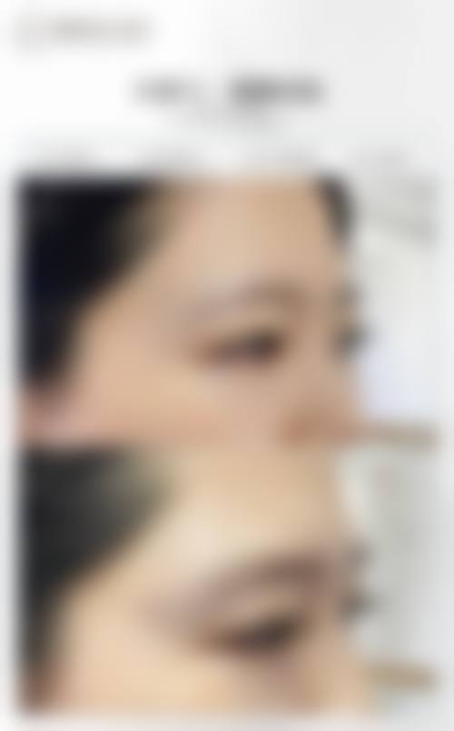 五、上海爱度医疗美容门诊真实实例参考