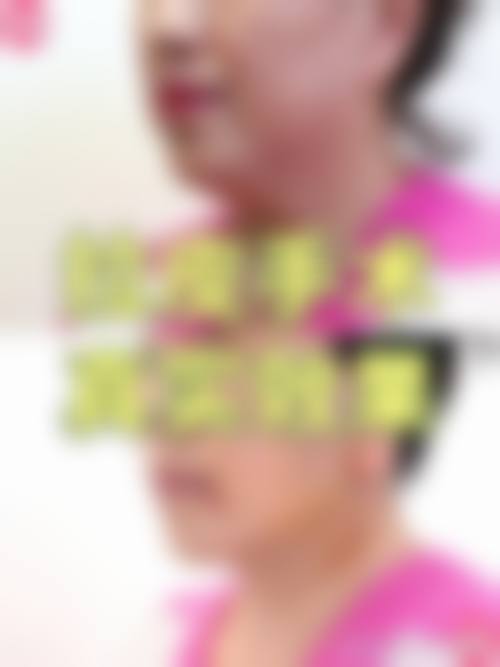 成都九州华昀惠芝美韵整形医院医生团队经验稳定。