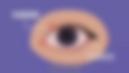 普瑞眼科集团擅长项目。