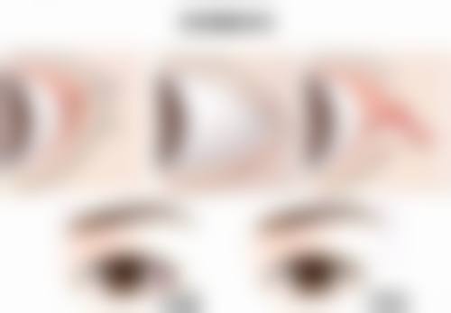韓國Benjamin皮膚科價格表2026中韓報價:港澳姐妹赴韓必知避坑指南