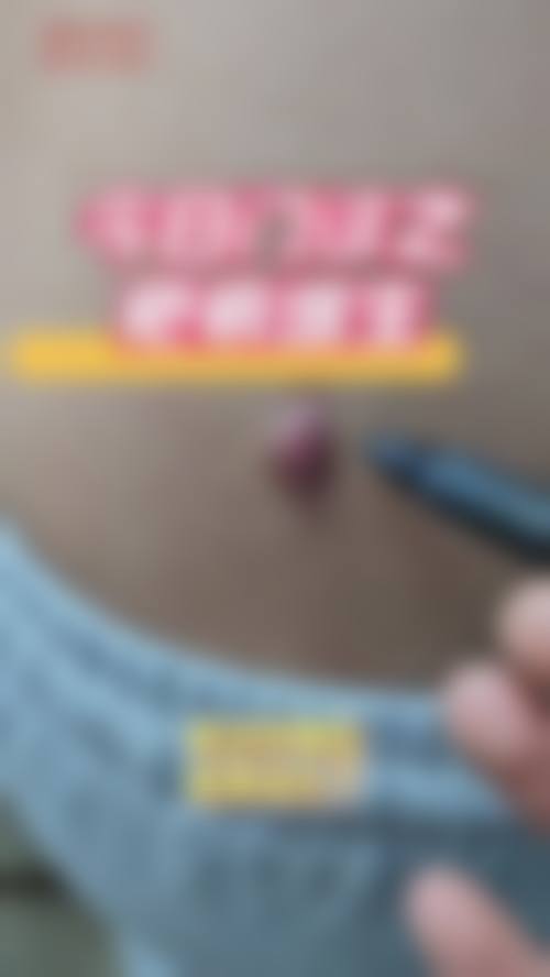 2、【歪鼻矫正】核心技术优势