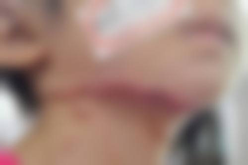 十四、明石Erumi美容外科患者常见问答