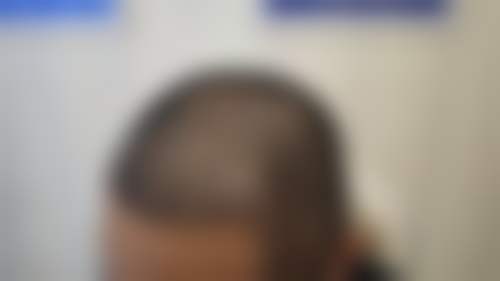 赵桐医生擅长的治疗项目