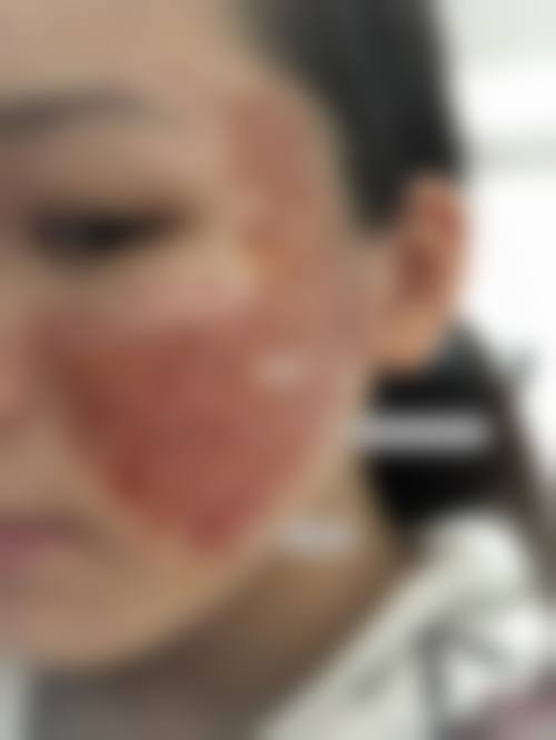 锦州博美雅医疗美容医院治疗反馈与口碑评价。
