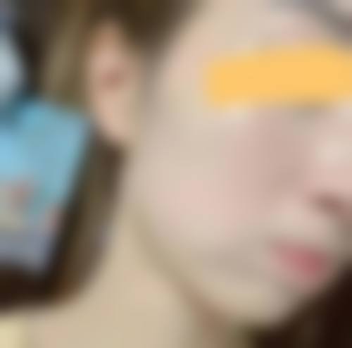 锦州博美雅医疗美容医院擅长项目。